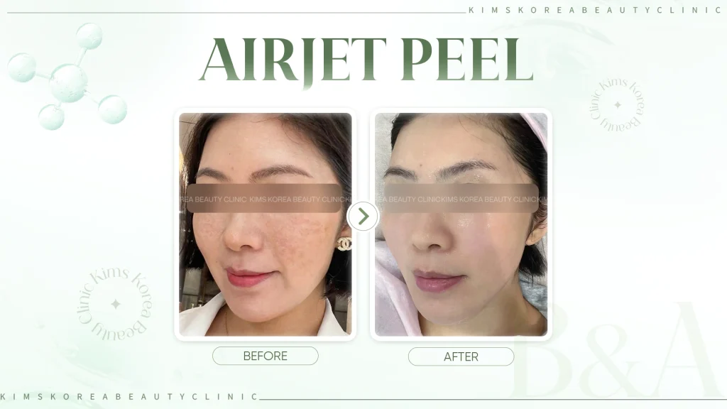 airjetpeel-hinh-2