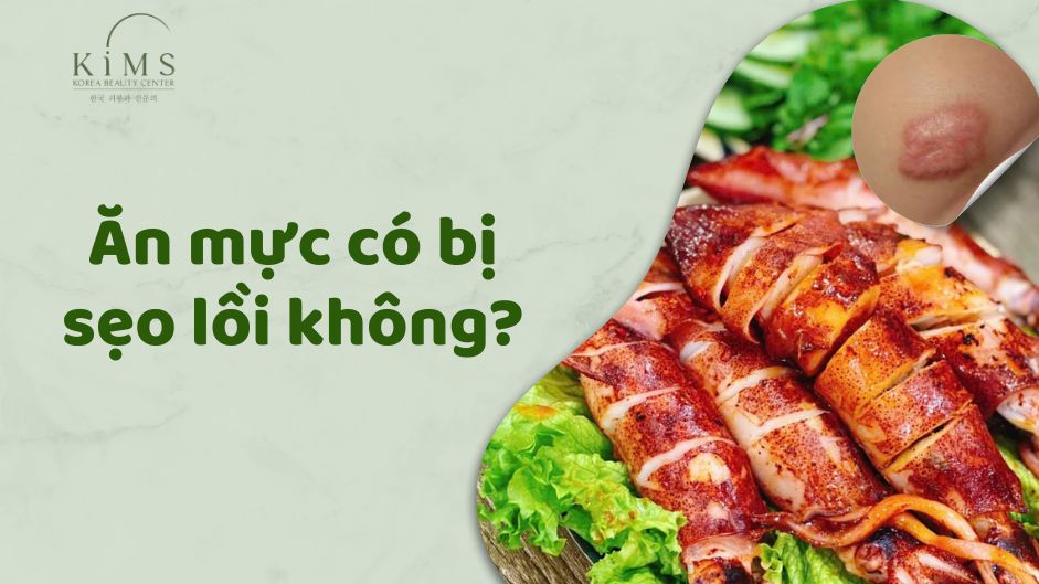 ăn mực có bị sẹo lồi không