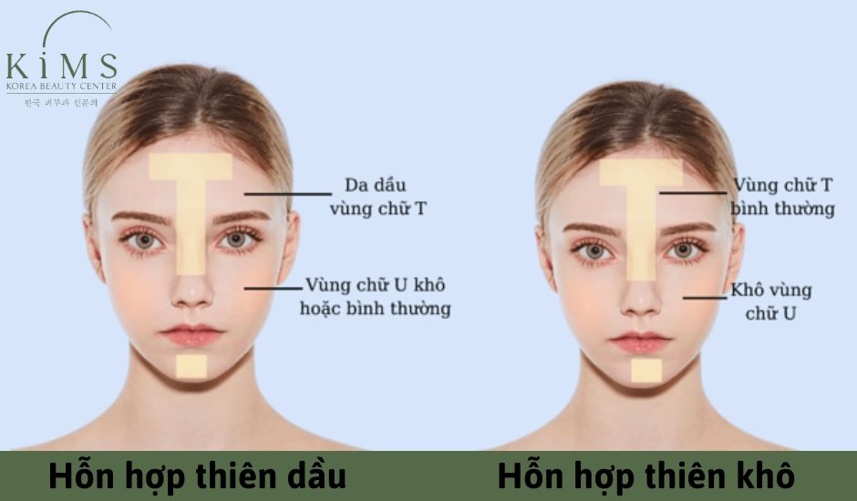 Các loại da hỗn hợp phổ biến.