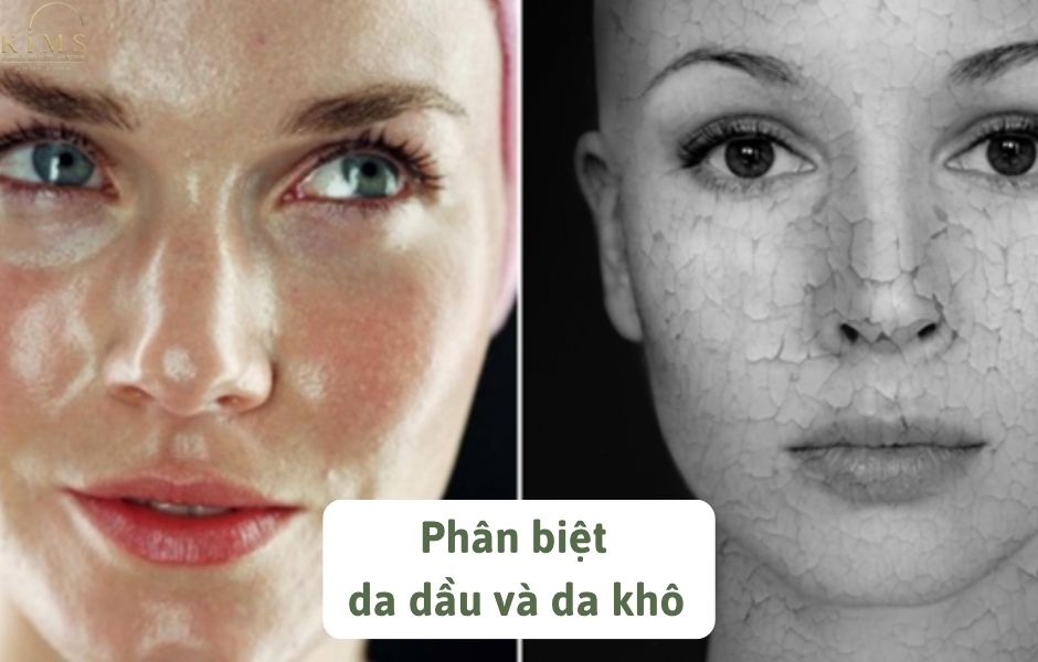 Phân biệt da dầu và da khô