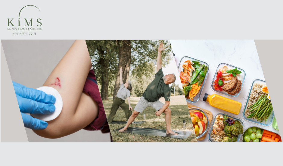 Lưu ý và cách chăm sóc vết thương để tránh bị sẹo lồi