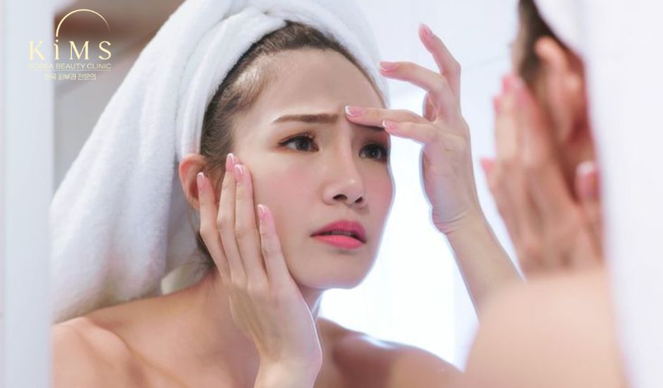 Lưu ý khi skincare cho da dầu mụn.