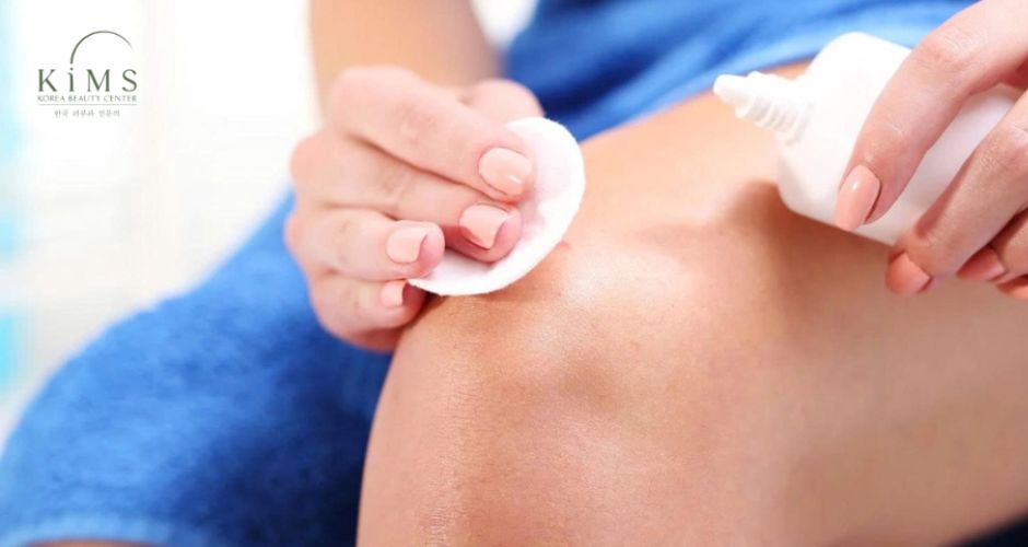 Vệ sinh vết thương bằng nước muối sinh lý.