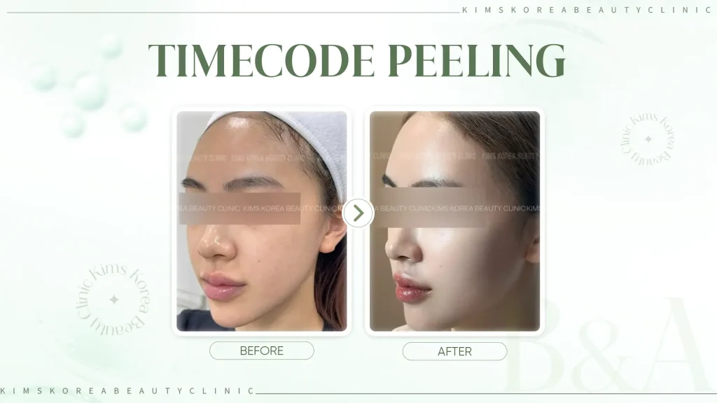 HINH-3---TIMECODE-PEELING