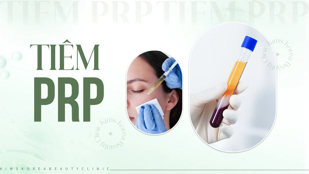 tiêm PRP