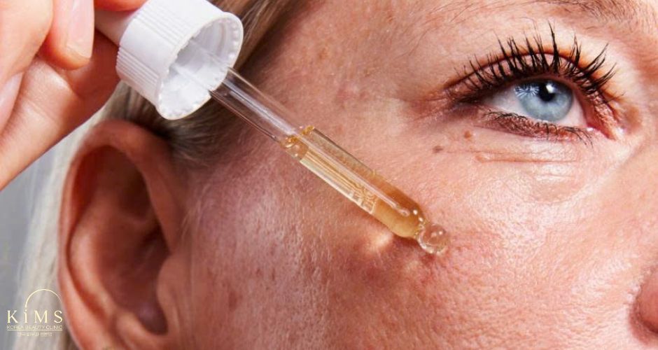 Kết hợp tretinoin và corticosteroid để tăng hiệu quả trị nám.