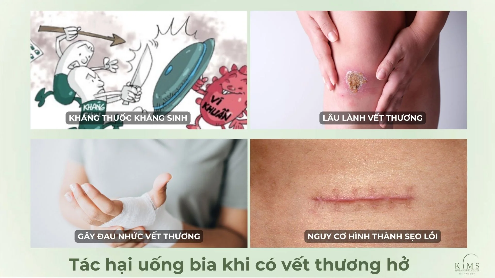 Tác hại uống bia khi có vết thương hở