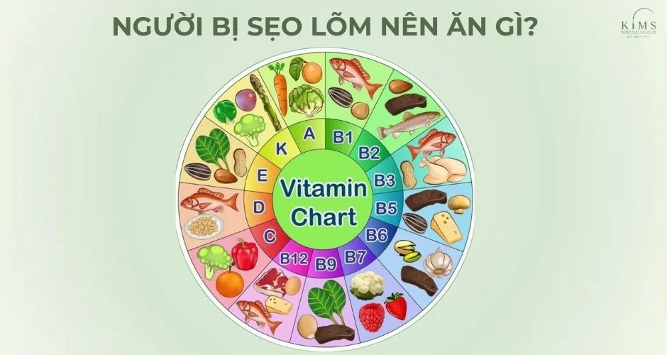 Người bị sẹo lõm nên ăn gì?