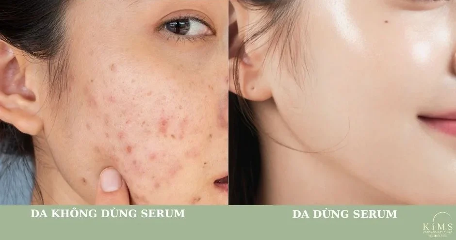 Sự khác biệt da dùng và không dùng serum.