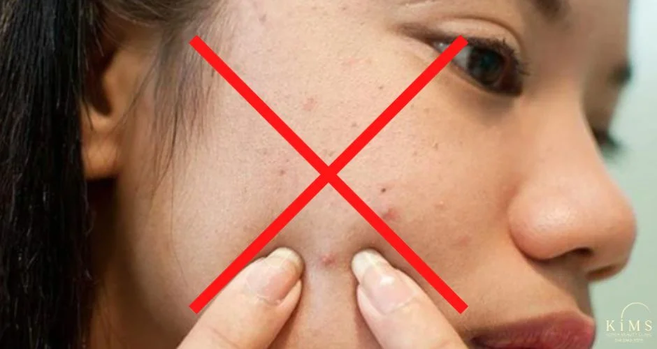 Tuyệt đối không sờ tay lên mặt.