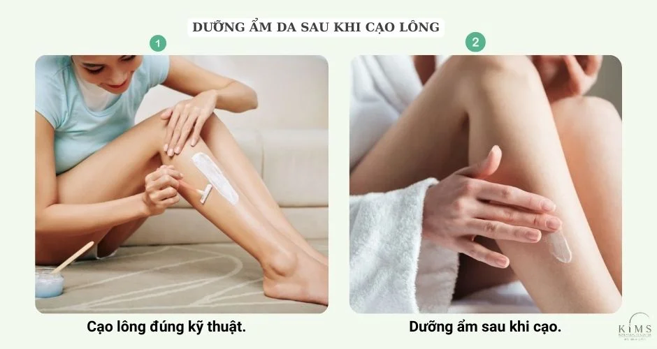 Đừng quên dưỡng ẩm sau cạo để bảo vệ da.