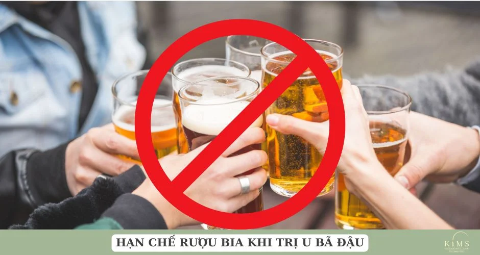 Hạn chế rượu bia.