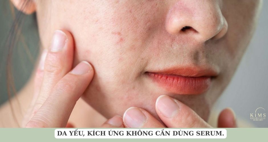 Serum (huyết thanh) là một loại tinh chất đặc trị giúp nuôi dưỡng, phục hồi.