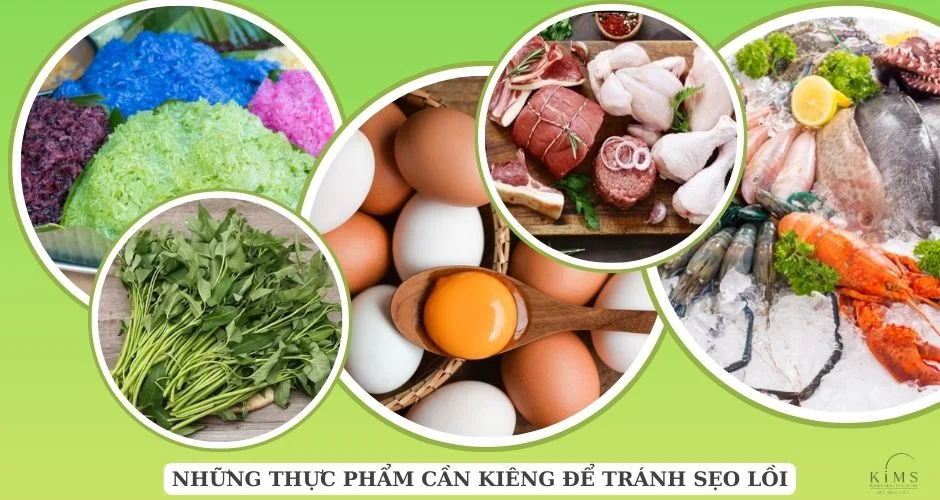 Nhóm thực phẩm cần kiêng.