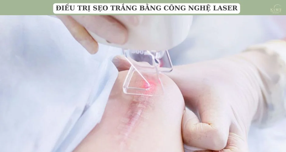Điều trị sẹo trắng bằng công nghệ laser.