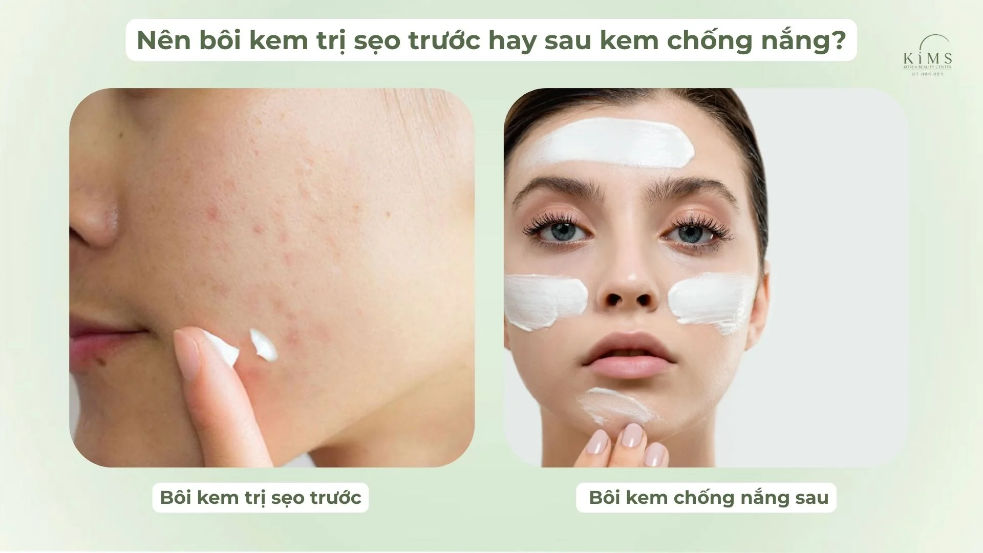 Nên bôi kem trị sẹo trước hay sau kem chống nắng?