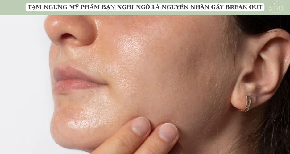 Tạm ngưng mỹ phẩm bạn nghi ngờ là nguyên nhân gây break out.