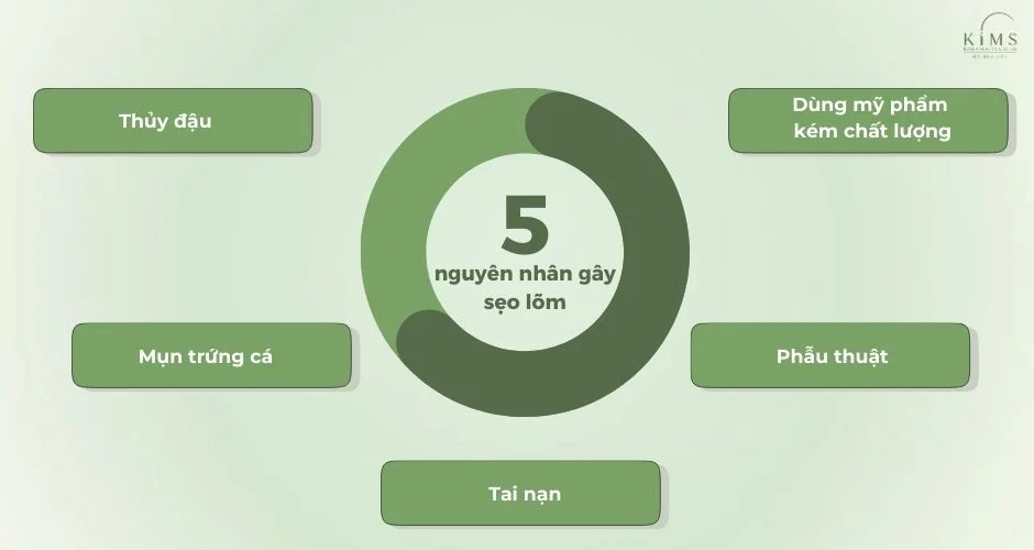 Nguyên nhân gây sẹo lõm.