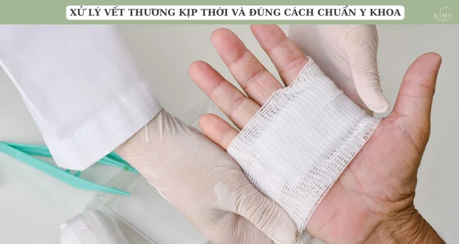 Xử lý vết thương kịp thời và đúng cách chuẩn y khoa.