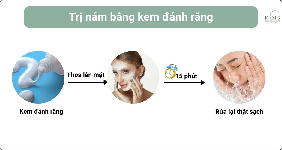 Dùng kem đánh răng thoa trực tiếp lên da.