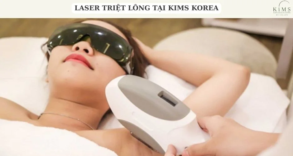 Laser triệt lông tại Kims.
