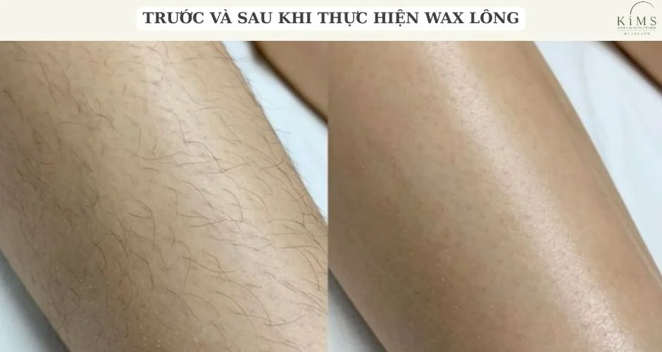 Sau khi wax lông bao lâu thì bôi mỡ trăn và một số lưu ý