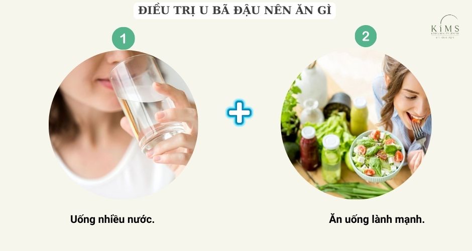 Điều trị u bã đậu nên ăn gì?