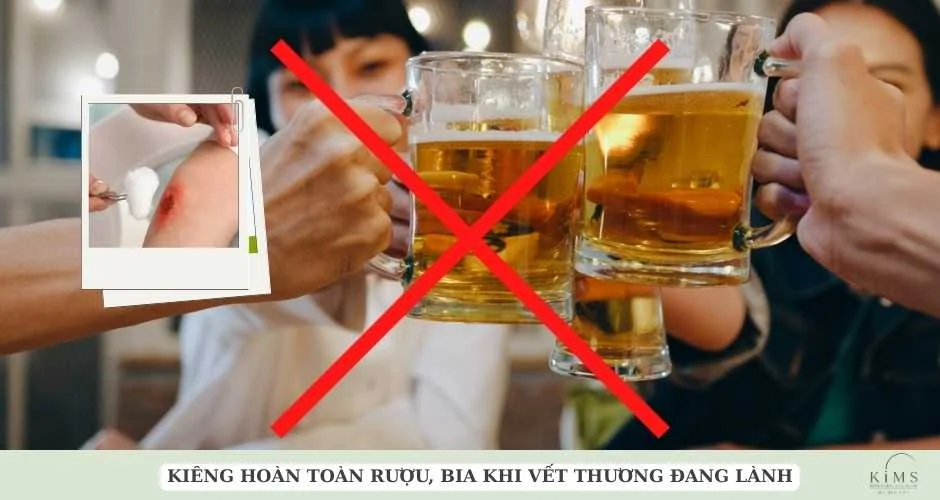 Uống bia có bị sẹo lồi không?