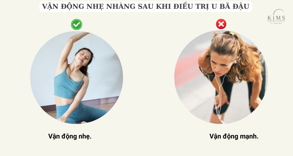 Duy trì thói quen tập thể dục giúp tăng lượng bạch huyết.