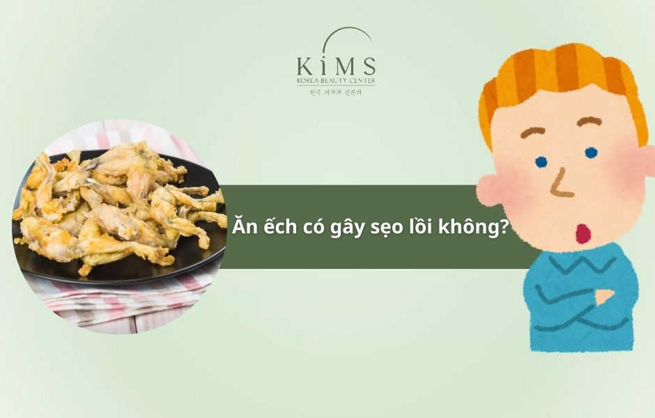 Ăn ếch có gây sẹo lồi không?