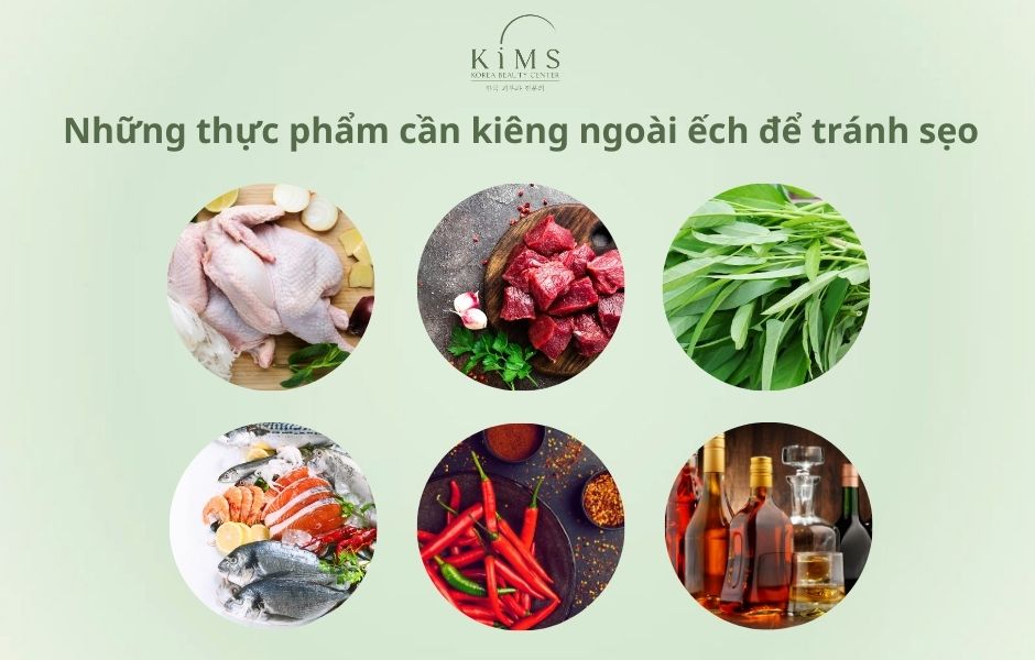 ăn ếch có bị sẹo lồi không