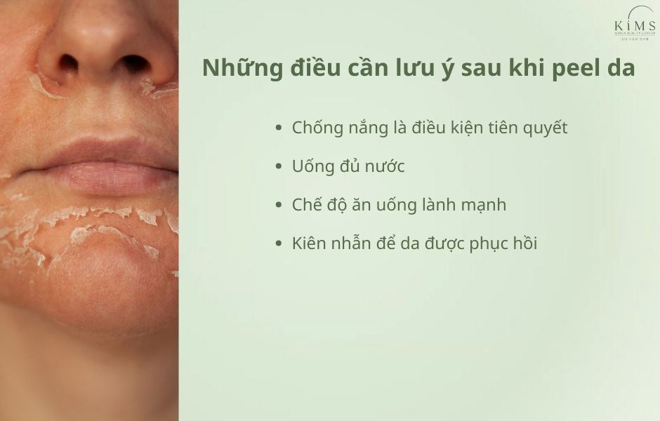 Peel da bị ngứa phải làm sao