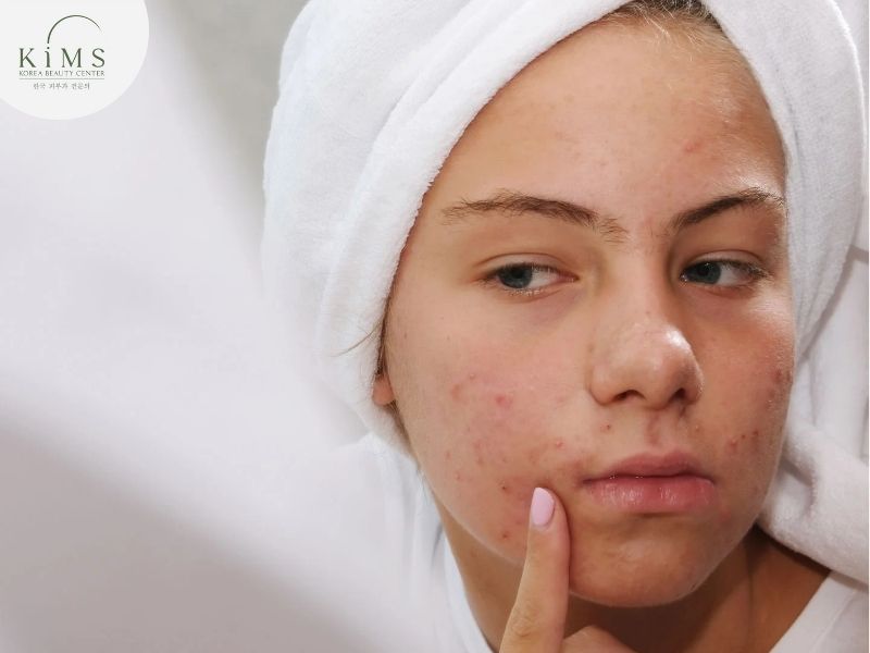 Tuổi dậy thì có thể bắt đầu skincare đơn giản để giúp da mạnh khỏe