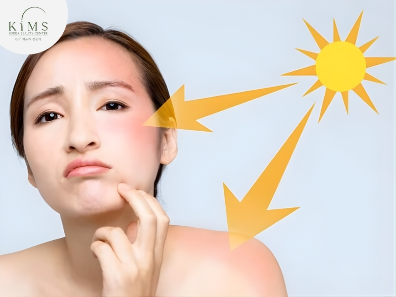 Ánh nắng mặt trời kích thích sắc tố melanin phát triển mạnh mẽ