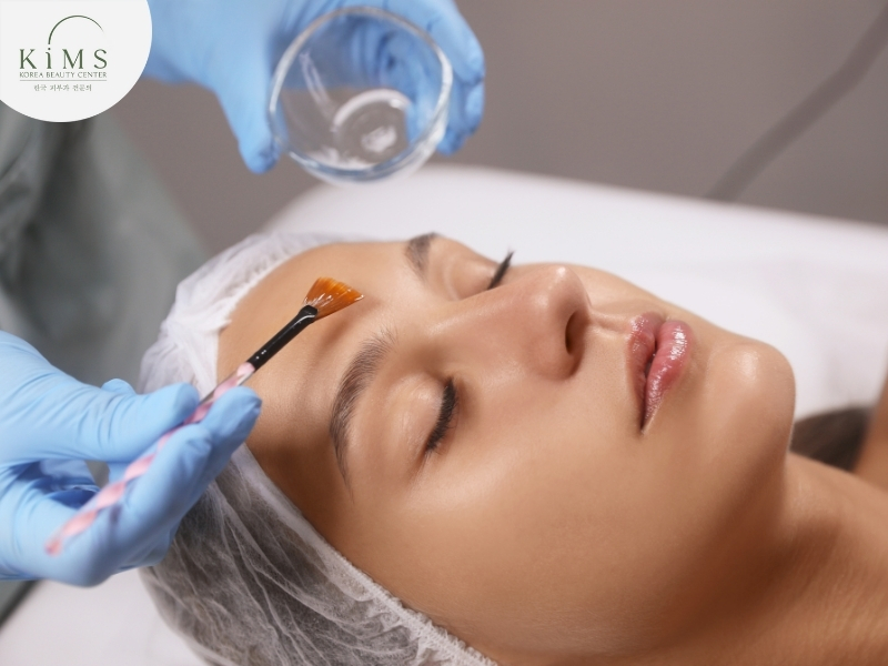 Peel da hóa học giúp loại bỏ tế bào chết và tái tạo làn da mới