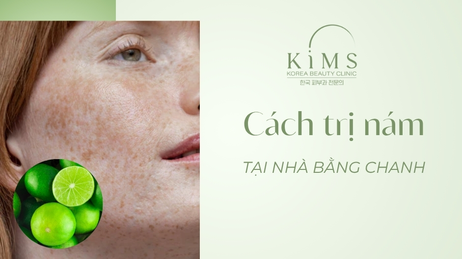 Cách trị nám tại nhà bằng chanh: Bật mí 11 công thức da sáng mịn