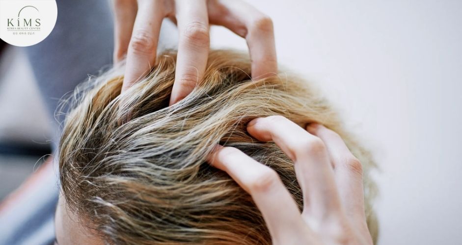 Vệ sinh nhẹ nhàng và tránh tác động mạnh vào vùng cấy tóc