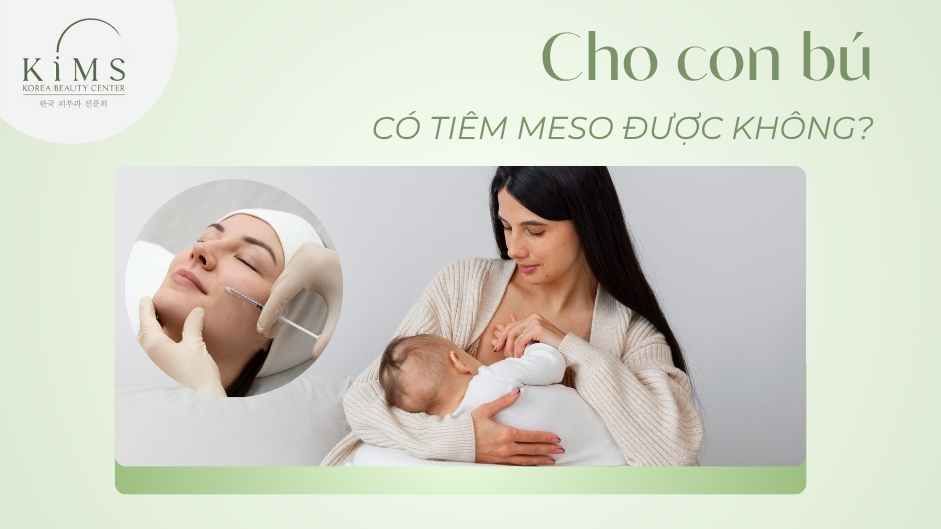 Cho con bú có tiêm meso được không? Lưu ý và giải đáp từ chuyên gia