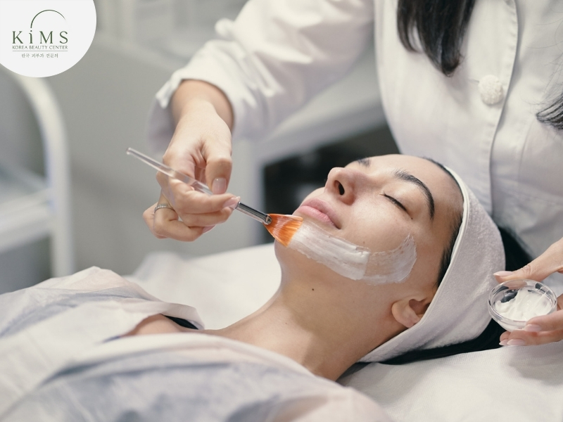 Phương pháp peel da giúp cải thiện làn da mụn và làm mờ vết thâm.