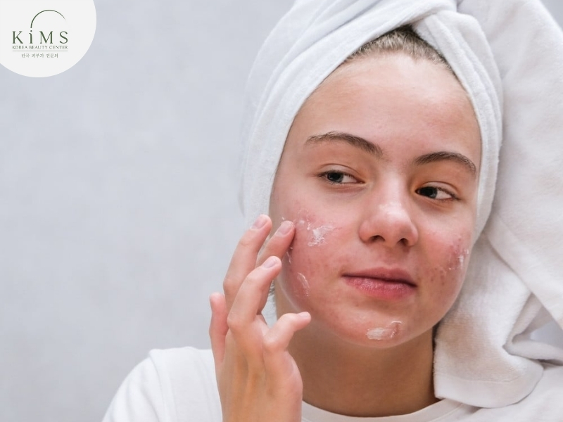 Sau 3 ngày da phục hồi bạn có thể dùng kem chống nắng dịu nhẹ.