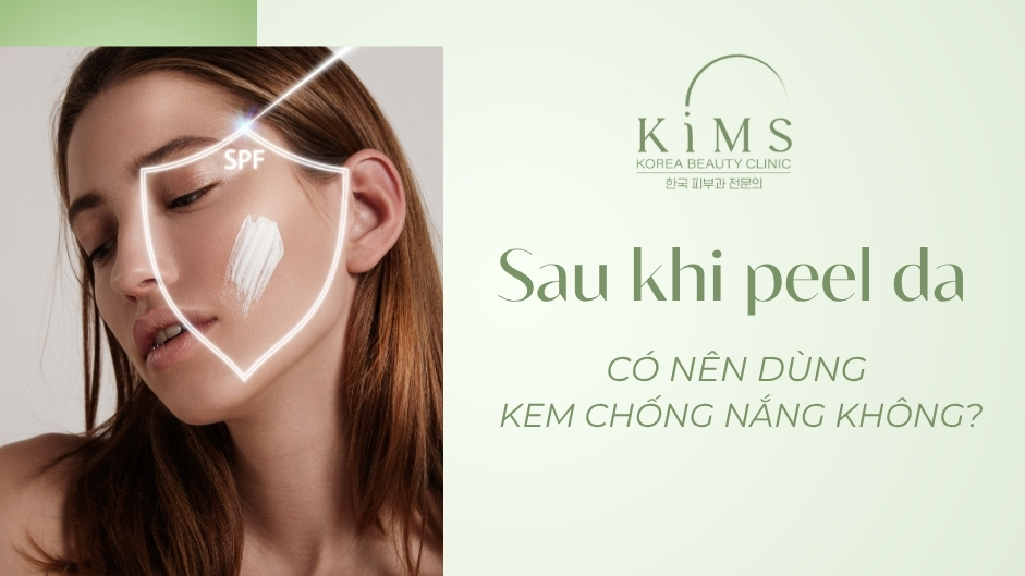 Sau khi peel da có nên dùng kem chống nắng không? Cách chống nắng đúng