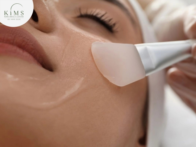 Peel da nông giúp loại bỏ tế bào chết và cải thiện bề mặt da nhẹ nhàng.