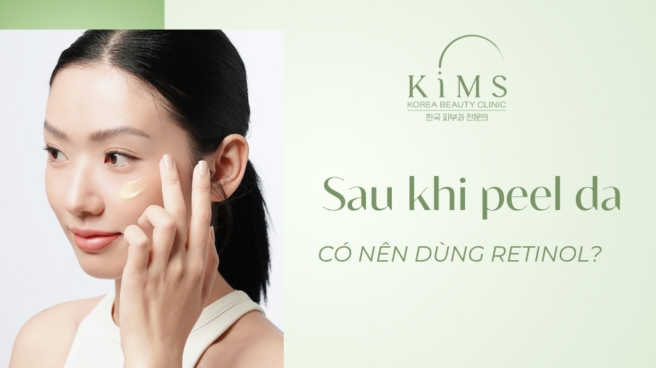 Sau khi peel da có nên dùng Retinol? Bao lâu dùng lại được?