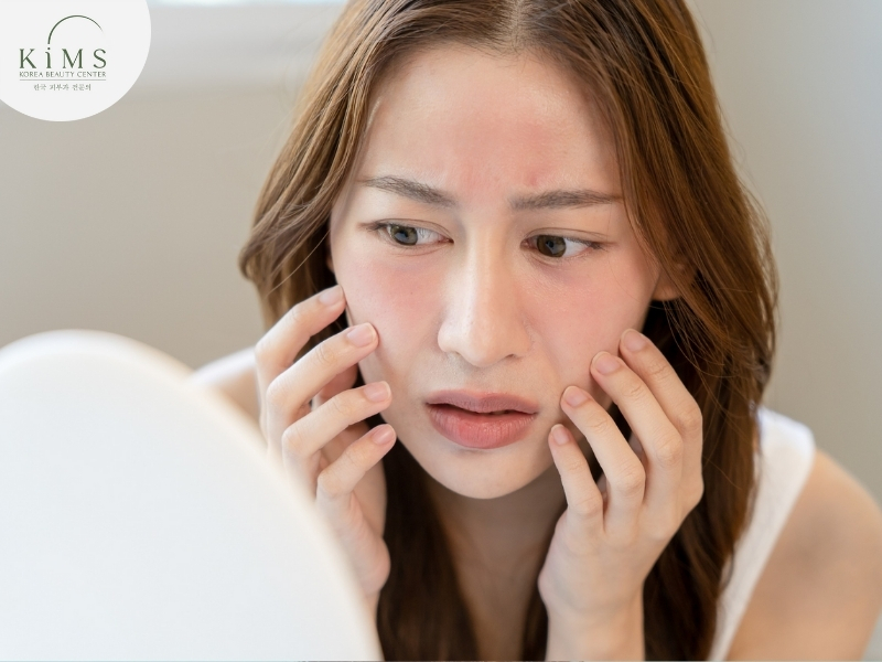 Da dễ bị kích ứng và mẩn đỏ nếu dùng vitamin C quá sớm.