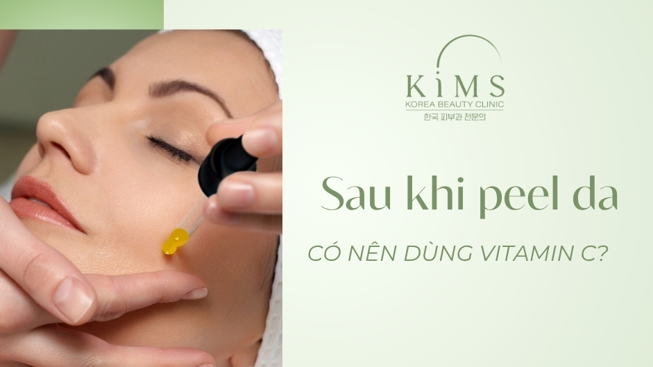 Sau khi peel da có nên dùng vitamin C? Sau bao lâu dùng an toàn?