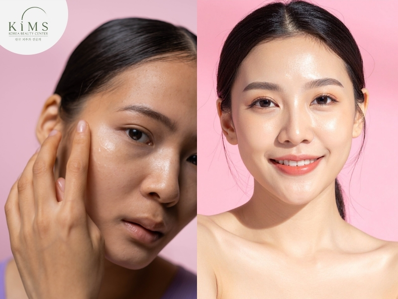 Làn da khô và xỉn màu là dấu hiệu cần được chăm sóc chuyên sâu trở lại