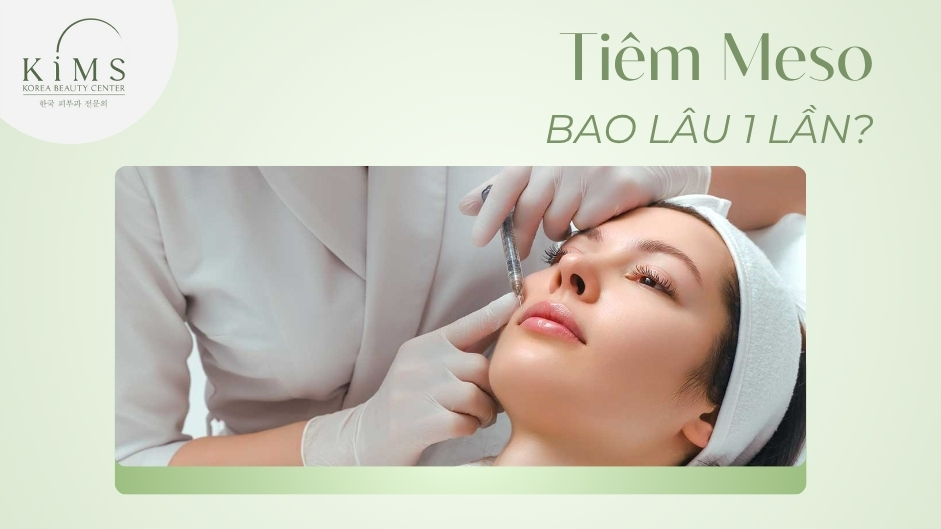 Tiêm meso bao lâu 1 lần để tối ưu và duy trì làn da đẹp?