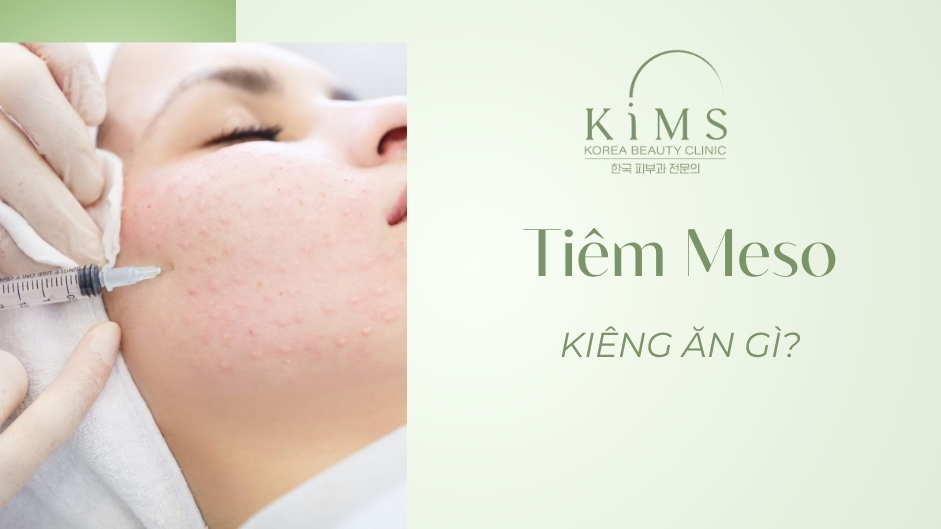 Tiêm Meso kiêng ăn gì để tránh biến chứng và tổn thương da?