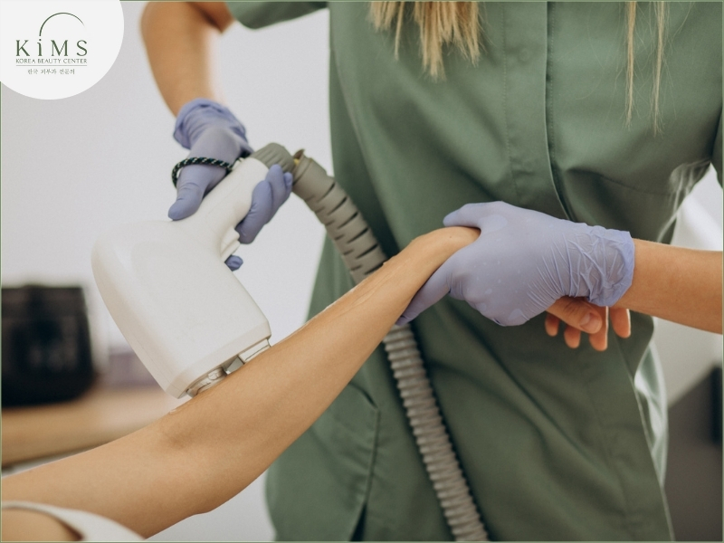 Khoảng cách giữa các lần triệt khác nhau tùy cơ địa.