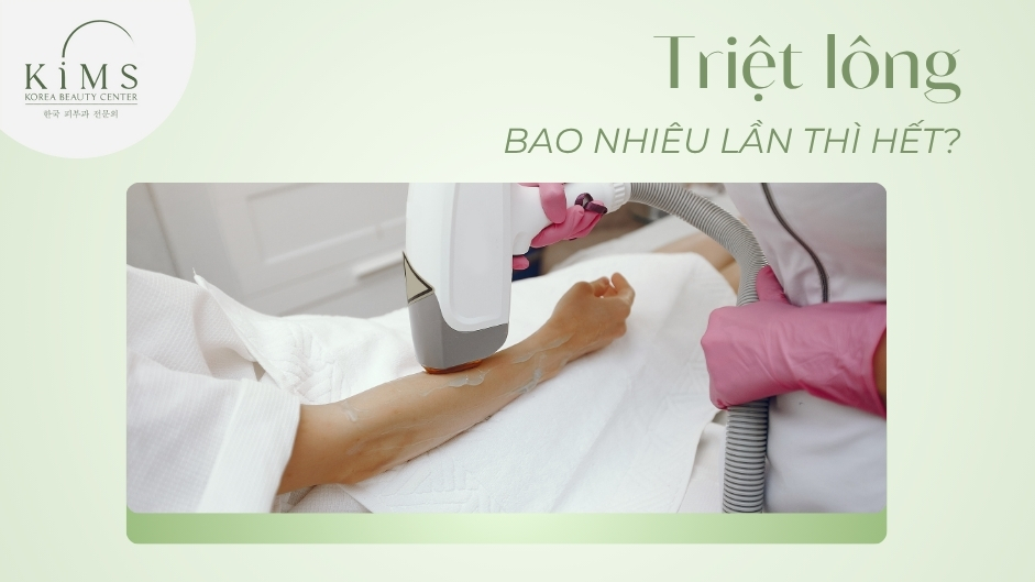 Triệt lông bao nhiêu lần thì hết và có hết vĩnh viễn không?